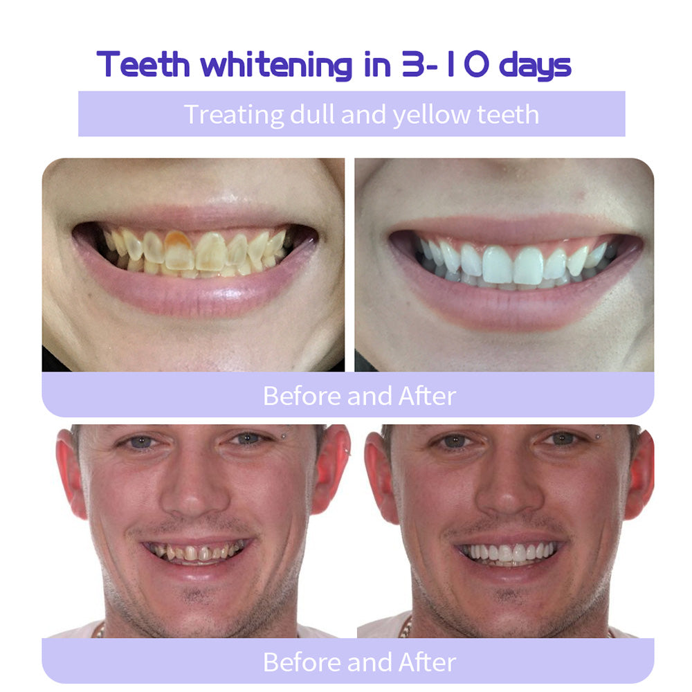 BBOJI™ Fluoride-Free Nano-Hydroxyapatite Toothpaste🦷(ADA recommended)(🎁Flash Sale - Don’t Miss Out)