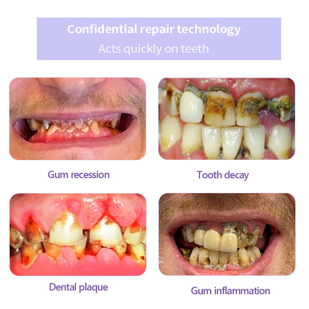BBOJI™ Fluoride-Free Nano-Hydroxyapatite Toothpaste🦷(ADA recommended)(🎁Flash Sale - Don’t Miss Out)