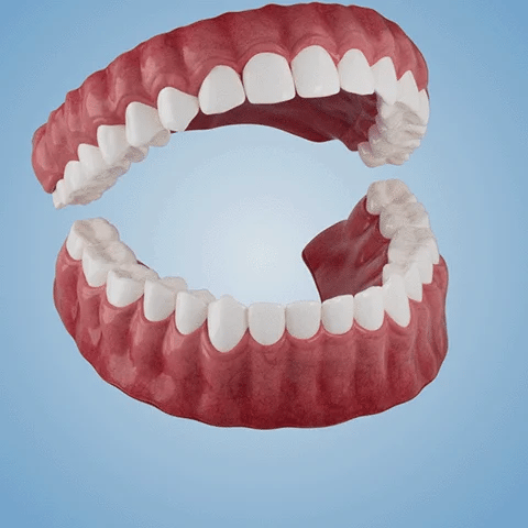 ✅Official Store: QIAWI™ Adsorptive denture(⏰Limited time discount last 30 minutes⏰)